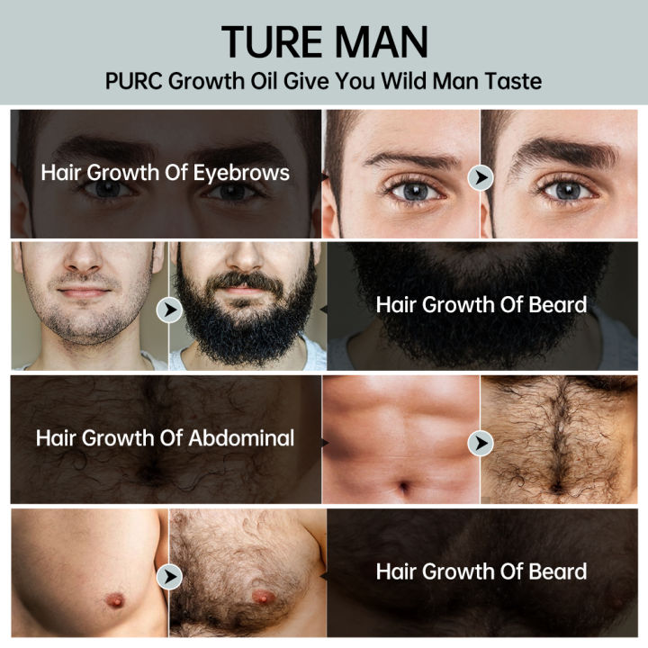 PURC%20Beard%20Growth%20Oil%20Hair%20Growth%20Products%20for%20Men%20Rosemary%20Oil%20Beard%20Fast%20Regrowth%20Nourishing%20Enhancer%20Treatment%20Hair%20Care%20Lateil%20-%20Image%203