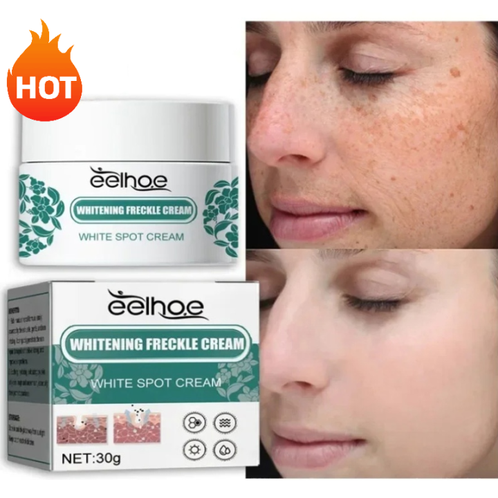 Desalinate Melasma Cream Reduces Melanin and Improves Dry Dull for Women Replenishing Facial Moisture Skin Lifting Care Cream