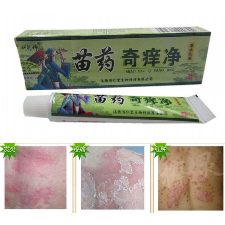 China Hmong Balm Inhibition Fungal infections Foot And Ringworm Actinic ...