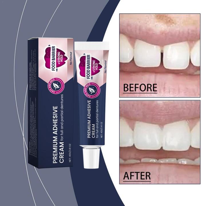 40g Fixodent Dental Adhesive Cream For Denture Original Strong Complete Professional Dentures Glue Dentistry Products Mater