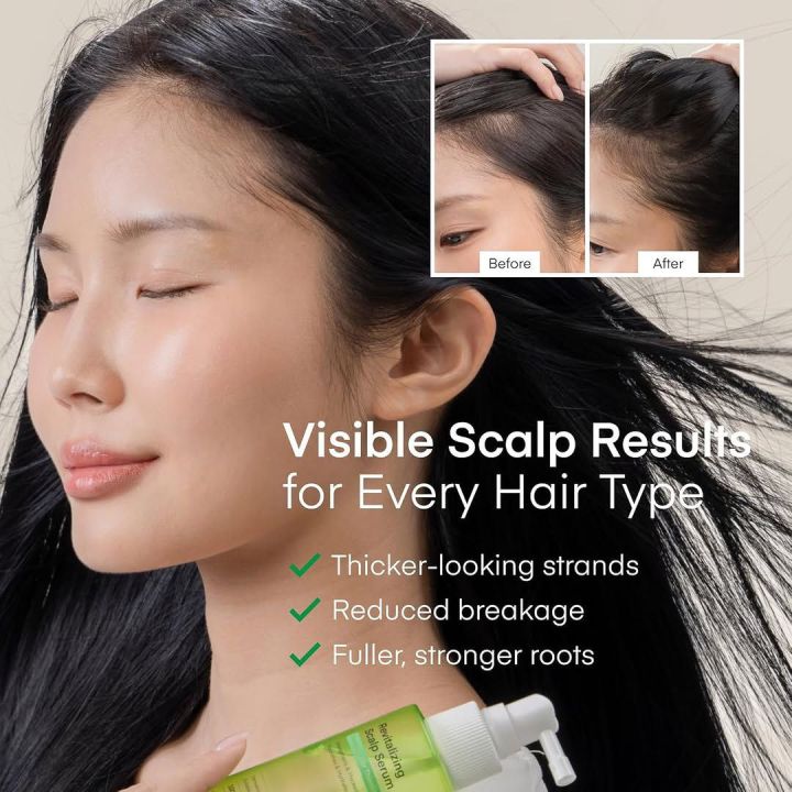Scalp%20Serum%20for%20Hair%20Growth%20Spray%20%E2%80%93%20Korean%20Vegan%20Treatment%20for%20Hair%20Loss,%20Thinning%20&%20Itchy%20Scalp,%20Non-Greasy,%20Lightweight%20Formula%20to%20Exfoliate%20Dandruff%20&%20Strengthen%20Roots%20%E2%80%93%20For%20Men%20&%20Women%20(100%20ML)%20-%20Image%205