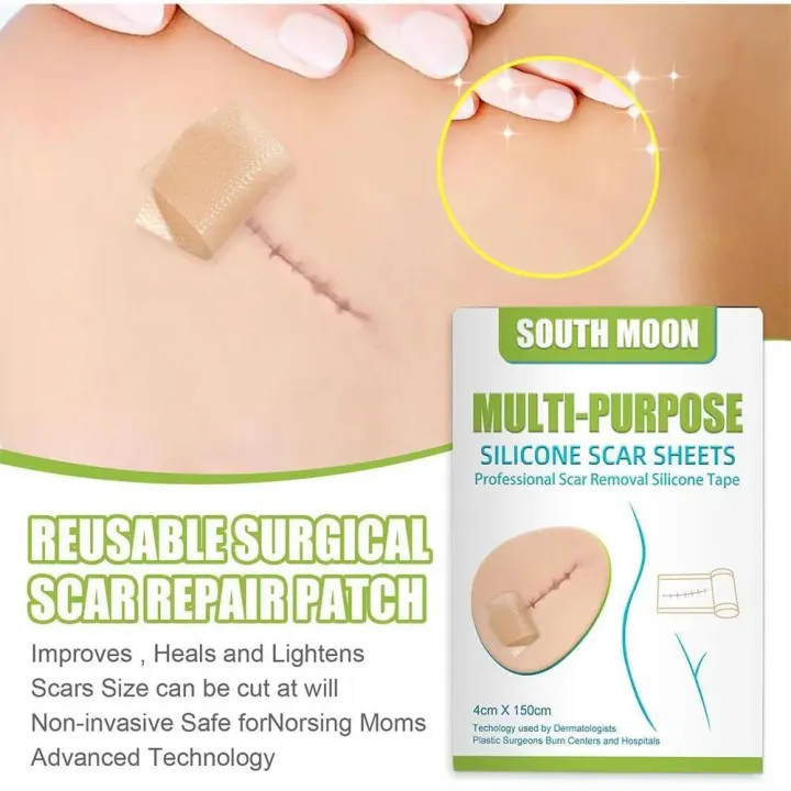 1Roll%20Scar%20Treatment%20Silicone%20Gel%20Sheet%20Efficient%20Surgery%20Scar%20Removal%20Therapy%20Patch%20For%20Acne%20Trauma%20Burn%20Scar%20Skin%20Repair%20-%20Image%206