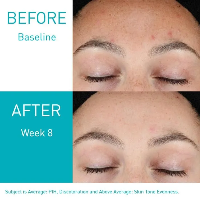 CeraVe%20Resurfacing%20Retinol%20Serum%2030%20Ml%20-%20Image%207