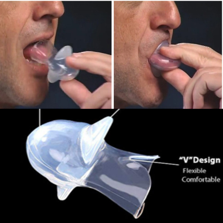 %E3%80%90beauty%20code%20store%E3%80%911PCMedical%20Silicone%20Snore%20Apnea%20Aid%20Snore%20Stop%20Tongue%20Retainer%20Snoring%20Mouthpiece%20-%20Image%202