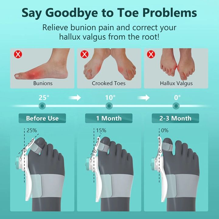 Unisex%20Orthopedic%20Bunion%20Corrector%20Splint%20Toe%20Straightener%20Adjustable%20Knob%20Hallux%20Valgus%20Toe%20Corrector%20Pedicure%20Foot%20Care%20Tools%20-%20Image%203