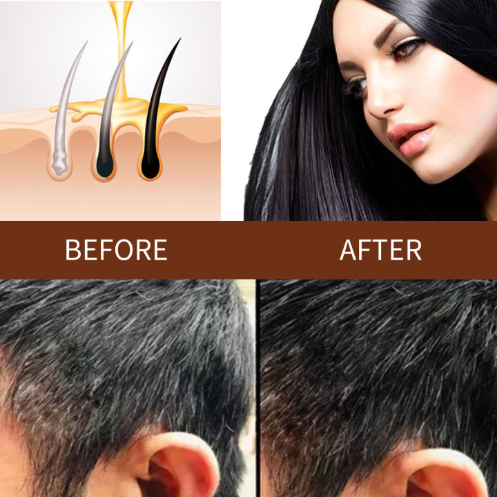 Chines%20Herbal%20Polygonum%20multiflorum%20hair%20soap%20Blacken%20hair%20and%20prevent%20hair%20loss%2060g-Get%201%20Foam%20Net%20Free%20-%20Image%206