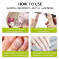 Efero Nail Repair Treatment Gel Fungus Cream-20gm  Bix super shop. 