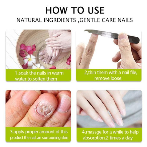 Efero%20Nail%20Repair%20Treatment%20Gel%20Fungus%20Cream-20gm%20%20Bix%20super%20shop%20-%20Image%204