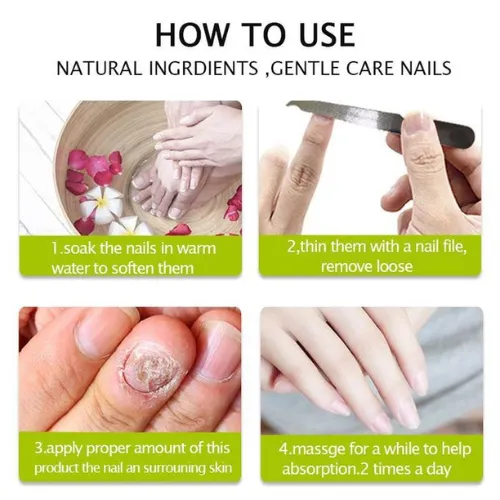 Efero%20Nail%20Repair%20Treatment%20Gel%20Fungus%20Cream-20gm%20%20Bix%20super%20shop%20-%20Image%204