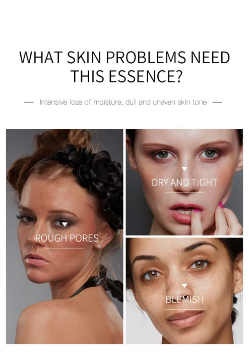 Dimollaure%20Whitening%20Freckle%20Cream%20Moisturize%20Firming%20Anti-Wrinkle%20Remove%20Dark%20Spots%20Melasma%20Melanin%20Bright%20Face%20Korea%20Skin%20Care%20-%20Image%206