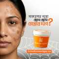Melasma Remover Cream. 