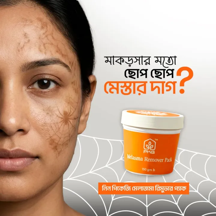 Melasma%20Remover%20Cream%20-%20Image%204