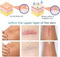 Advanced Scar Gel For Acne Scars Stretch Mark Removal Cream Advanced Scar Treatment 50ml,Natural Scar Therapeuti Gel,Advanced Skin Renewal Gel,Scar Removal Cream for Old Scars (1 Pcs). 