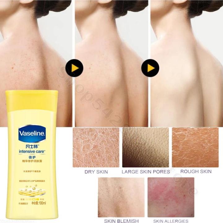 Vaseline%20Repairing%20Body%20Lotion%20100ml%20Whitening%20Moisturizing%20Improves%20Dry%20Peeling%20Repairs%20Damaged%20Skin%20Barrier%20Fine%20Pores%20-%20Image%203