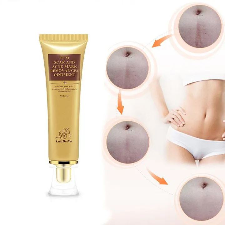 Lanbena%20Tcm%20Scar%20And%20Acne%20Mark%20Removal%20Gel%20Ointment%2030G%20Acne%20Scar%20Cream%20Beauty%20W%20-%20Image%202
