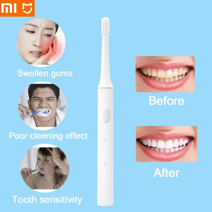 XIAOMI%20MIJIA%20T100%20Sonic%20Electric%20Toothbrush%20Original%20Teeth%20Whitening%20Ultrasonic%20Vibrating%20IPX7%20USB%20Charging%20Smart%20Toothbrushes%20-%20Image%202