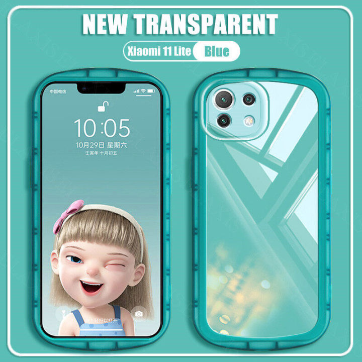 AnDyN%20phone%20case%20for%20Xiaomi%20Mi%2011%20Lite%205G%20NE%20Phone%20Case%20New%20Transparent%20Big%20Eyes%20Ultra-Thin%20Lens%20All-Inclusive%20Silicone%20Soft%20Case%20-%20Image%202