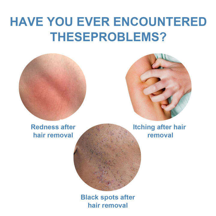 Body%20armpits%20and%20legs%20Hand%20permanent%20hair%20suppression%20serum%20Prevent%20hair%20growth%20Body%20and%20arms%20Moisturizing%20and%20whitening%20Powerful%20painless%20hair%20removal%20serum%20-%20Image%203