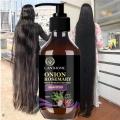 Hair Shampoo For Fast Hair Growth Rosemary Onion Hair Regrowth Shampoo Anti Hair Loss Effective Within 7 Day Hair Growth Product.
