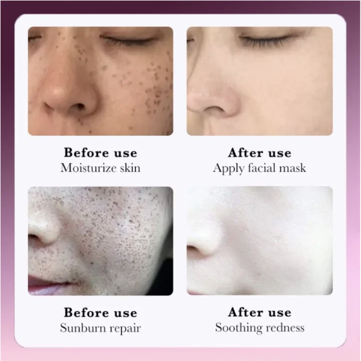 SADOER%20Niacinamide%20Whitening%20Anti-Freckle%20Face%20Serum,%20Black%20Spot%20Remover%20and%20Skin%20Moisturizer%20with%20Repair%20&%20Brightening%20Face%20Essence%20-%20Image%206