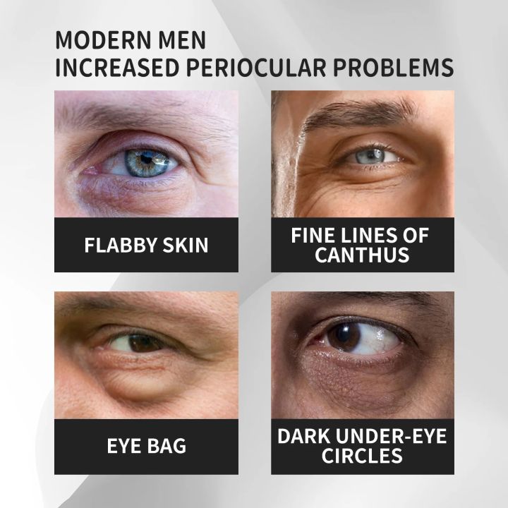 Eye%20Bag%20Removal%20Cream%20Men%20Anti%20Age%20Wrinkle%20Dark%20Circles%20Under%20The%20Eyes%20Remover%20Lifting%20Firm%20Skin%20Brightening%20Moisturizer%20Cream%20Abandon%20Abandon%20-%20Image%205