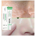 Salicylic Acid Pore Shrinking Cream Quick Elimination Large Pores Remove Blackehead Tighten Face Smooth Skin Care Product New. 