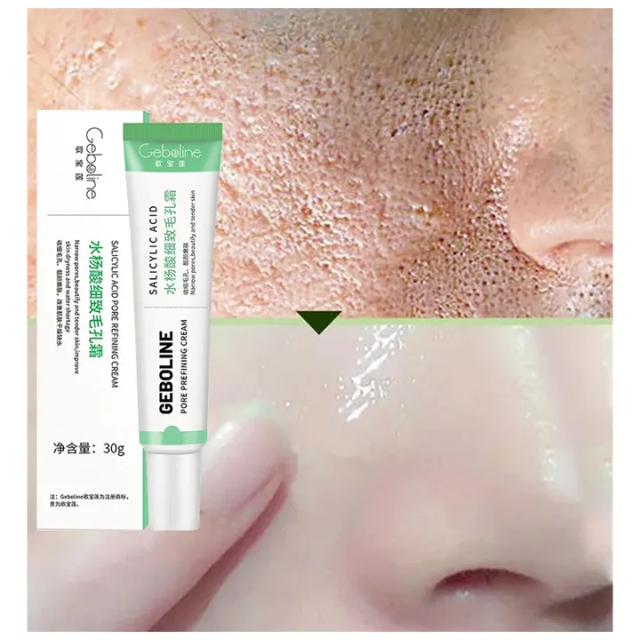 Salicylic%20Acid%20Pore%20Shrinking%20Cream%20Quick%20Elimination%20Large%20Pores%20Remove%20Blackehead%20Tighten%20Face%20Smooth%20Skin%20Care%20Product%20New%20-%20Image%203