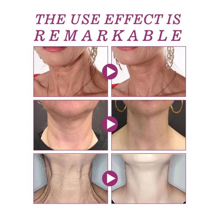 Hydrolyzed%20Collagen%20Neck%20Cream,Neck%20Firming%20Cream,Hydrolized%20Collagen%20Neck%20Cream,Neck%20Lifting%20Cream,%20Collagen%20Firming%20Neck%20Cream%20for%20Young%20and%20Smooth%20Skin%20-%20Image%206