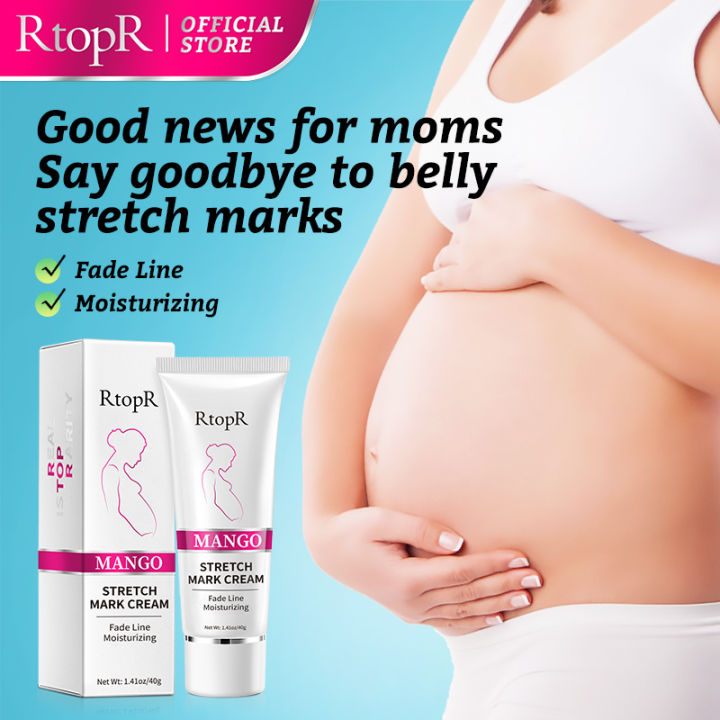 RtopR%20Mango%20Stretch%20Mark%20Cream%20Stretch%20Mark%20Repair%20Maternity%20Repair%20Cream%20Anti-Aging%20Anti-Wrinkle%20Firming%20Whitening%20Body%20Cream%2040g%20-%20Image%202