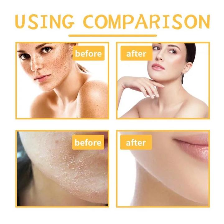 Turmeric%20Body%20Scrub%20Cleaning%20Exfoliation%20Removal%20Dark%20Spots%20Melanin%20Brighten%20Whitening%20Moisturizing%20Skin%20care%20peeling%20Cream%20-%20Image%204