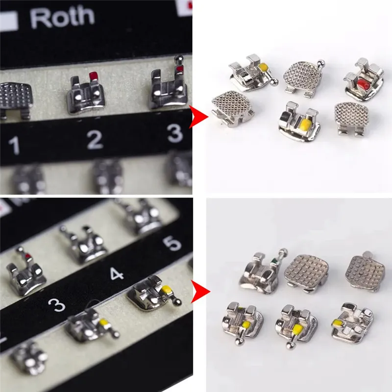 ROTH MBT 022 Brackets 20 Pack 20-Pack Dental Self-Ligating Brackets – Metal, ROTH MBT .022 3/345 With Hook Orthodontic Brackets ROTH MBT 022 Brackets 20 Pack 20-Pack Dental Self-Ligating Brackets – Metal, ROTH MBT .022 3/345 With Hook Orthodontic Brackets