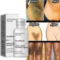 Whitening Cream for Dark Skin Armpit Intimate Areas Brighten Lotion Lightening Underarm Dull Body Skin Care Private Parts Bleach. 