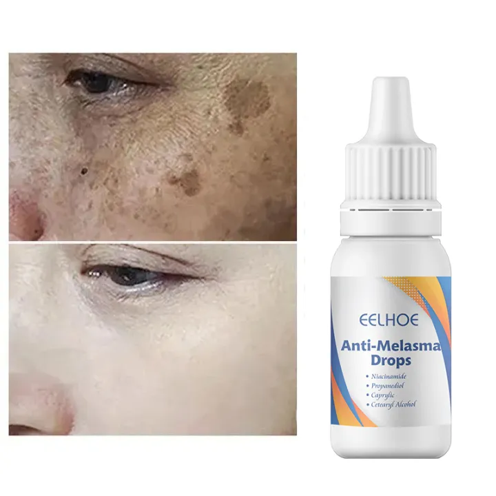 EELHOE%20Anti%20Melasma%20Drops%20%E2%80%93%20Brightening%20&%20Dark%20Spot%20Correcting%20Serum%20-%20Image%202