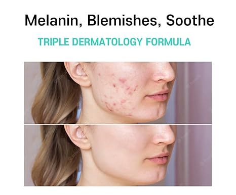 Melasma%20Treatment%20for%20Face%20Cream%20-%20Dark%20Spot%20Remover%20Centella%20Asiatica%20-%20Korean%20Skin%20Care%20Beauty%20Products%2040ml/1.35%20fl.oz%20-%20Image%203