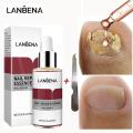 LANBENA Nail Repair Essence Serum Fungal Nail Treatment Remove Onychomycosis Toe Nourishing Brighten Hand Foot Skin Care 12ml.
