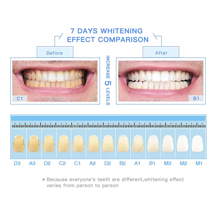 %EF%BC%88NEW%EF%BC%89Teeth%20Whitening%20Serum%20Gel%20Dental%20Oral%20Hygiene%20Effective%20Remove%20Stains%20Plaque%20Teeth%20Cleaning%20Essence%20Dental%20Care%20Toothpaste%20-%20Image%204