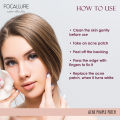 FA 186 - Focallure Acne Pimple Night Patch. 