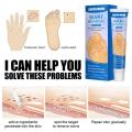 【Best value for money】 New 1 Foot Care Medical Corn Removal Pad Wart Thorn Curative Cream Callue Calloity Wart Ointment Treatment Againt Mole kin. 