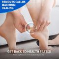 Corn Remover Patch ,High Efficacy Corn Treatment Pads, Fast Removes Corns and Calluses, Provides Cushioning Protection. 