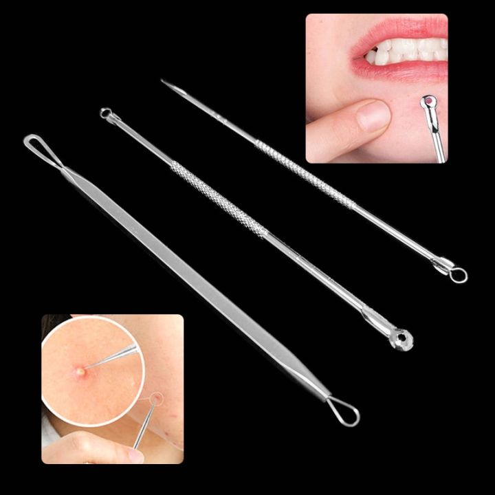 2/3/4/5PCS%20Stainless%20Steel%20Silver%20Blackhead%20Comedone%20Acne%20Pimple%20Blemish%20Extractor%20Blackhead%20Remover%20Tool%20for%20Face%20Skin%20Care%20-%20Image%203