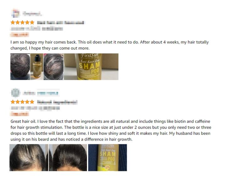 Unisex%20Anti%20Hair%20Loss%20Ginger%20Shampoo%20Hair%20Growth%20Products%20Shampoo%20Against%20Hair%20Loss%20Mild%20Treatment%20Ginger%20Shampoo%20For%20Hair%20Loss%20-%20Image%206