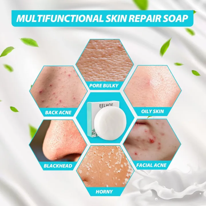 Silk%20Protein%20Skin%20Repair%20Soap%20Collagen%20Milk%20Whitening%20Soap,%20Exfoliating%20and%20Brightening%20Soap%20for%20Dull,%20Silk%20Protein%20Skin%20Repair%20Soap,%20Uneven%20Skin,%20Smooth%20And%20Soft%20Complexion%20for%20Face%20&%20Body%20-%20Image%204