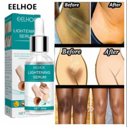 EELHOE%20Makes%20Brighter%20To%20Your%20Body%20And%20Posture%20Without%20Any%20Side%20Effect%20-%20Image%207