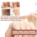 Dark s Fast Whitening Cream Pigmentation Correctors For Black Skin Hand Elbows Knee Intense Stains Remover Cream. 