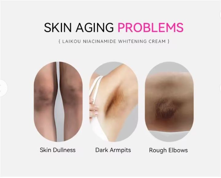 LAIKOU%20Niacinamide%20Whitening%20Lighten%20Spots,%20Moisture%20Cream-%20100g%20-%20Image%205