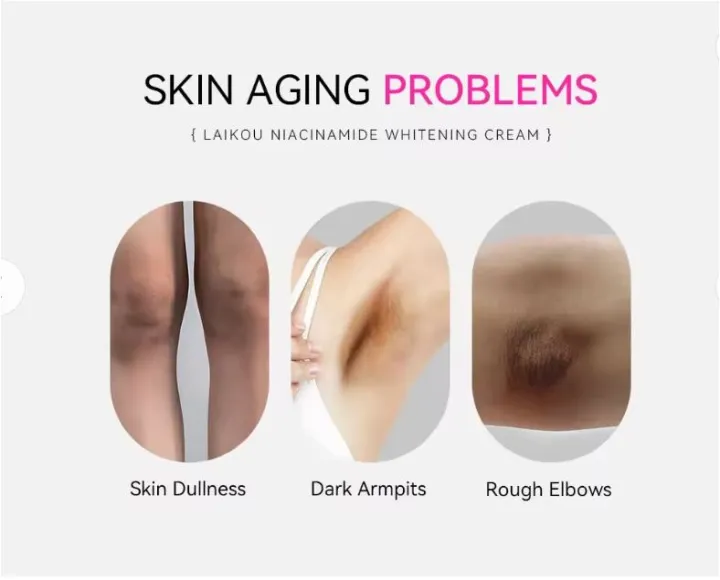 LAIKOU%20Niacinamide%20Whitening%20Lighten%20Spots,%20Moisture%20Cream-%20100g%20-%20Image%205