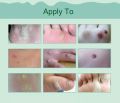 6 pcs Medical Plasters Foot Corn Removal Warts Thorn Patch Curative Patches Calluses Callosity Detox Foot Pads Toe Patches. 