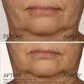 Neutrogena Rapid Firming Peptide Contour Lift Face Moisturizer Cream 50g. 