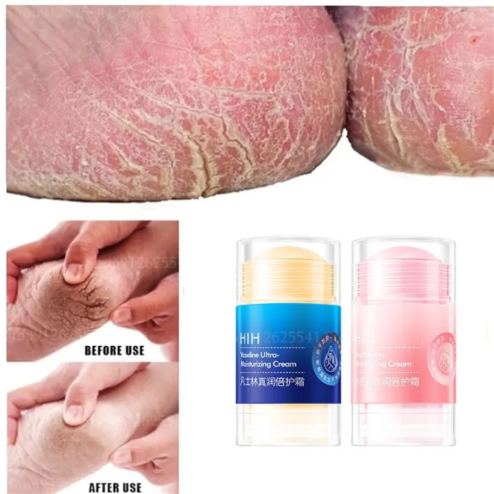 2Pcs%20Anti-Dry%20Cracked%20Foot%20Hand%20Cream%20Vaseline%20Moisturizing%20Cream%20Smooth%20Wrinkle%20Multi%20Balm%20Stick%20Removal%20Dead%20Skin%20Feet%20Care%20-%20Image%204