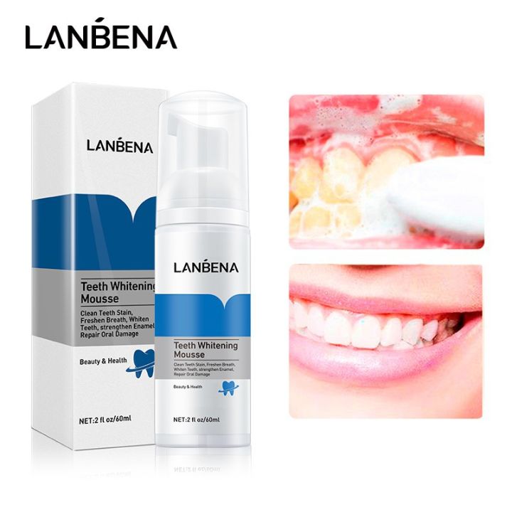 LANBENA Teeth Whitening Mousse Tooth Whitening Dental Tool Cleaning White Teeth Oral Hygiene Toothpaste Bleaching Remove Stains-60gm